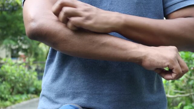 Young man scratching his arms and elbows due to skin allergy or insect bite outdoors