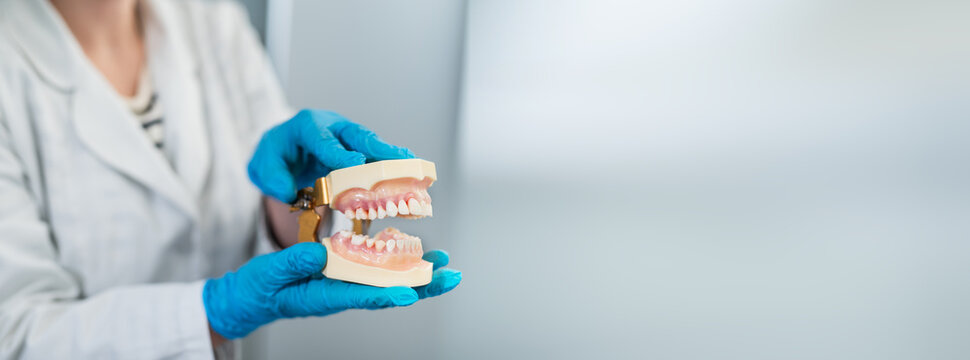 dentist wearing sterile gloves holds anatomical model of human jaw. close-up no face, making it unrecognizable. Gum inflammation, periodontal disease, stomatitis, gingivitis. banner copy space