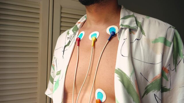 A man wearing a Holter monitor, a portable device that continuously records the heart's electrical activity, electrocardiogram.