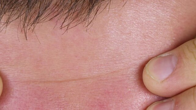 Male forehead wrinkles lines close up. Aging problems concept