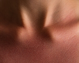 Fototapeta premium Sunburned Skin Texture on Neck and Collarbone Close-Up