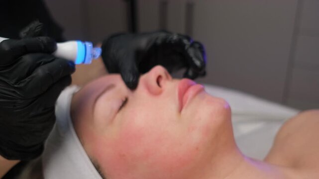 Cosmetologist performing a rejuvenating facial procedure with an led light therapy device