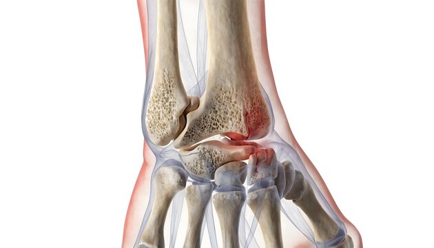 Detailed 3D medical illustration of a fractured human wrist featuring a broken distal radius and scaphoid. Translucent soft tissues and a highlighted red break on a white background for clinical use.