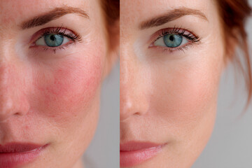 Obraz premium woman skin condition comparison