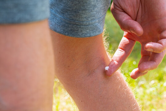Applying bug repellent cream for skin protection
