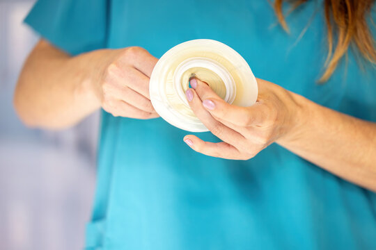 Nurse cutting template opening in ostomy baseplate for accurate stoma appliance fitting in clinical care