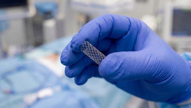 Coronary stent medical implant device held in surgical setting for cardiovascular interventional cardiology treatment and minimally invasive heart disease management