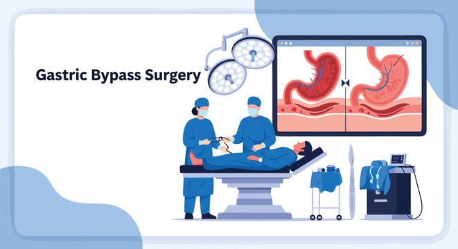 Medical illustration showing gastric bypass surgery being performed by a surgical team with anatomical diagrams of stomach procedures.