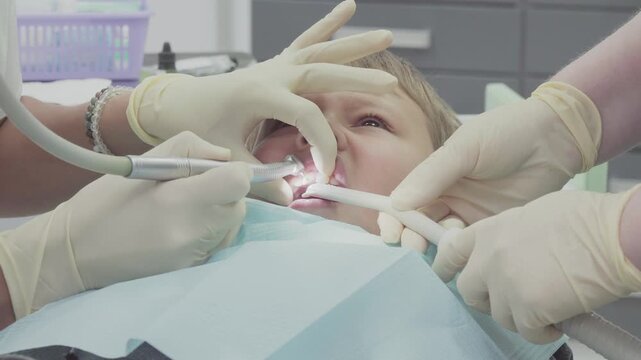 Dentist contouring the surface of a boys fractured tooth with a drill tool. The boy is laying down while the dentist focuses on the dental work