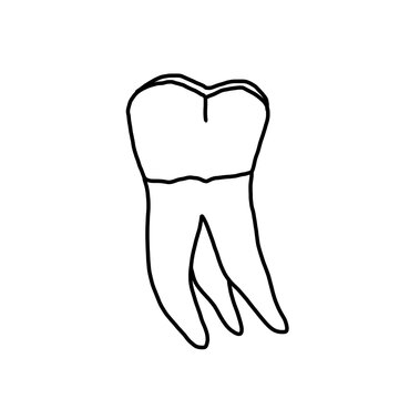 Anatomy of human tooth 17, US #2, maxillary right second molar drawn by a professional dental technician