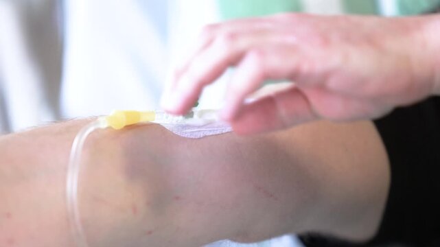 Close up of peripheral intravenous cannula inserted in patient arm during hospital infusion therapy