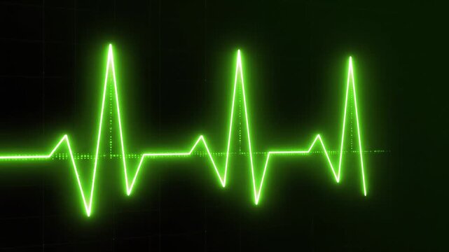 heart beat on monitor
