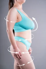 Unrecognizable curvy woman in underwear with arrows on fat body, concept of full body liposuction, plastic surgery, lifting and body contouring © staras