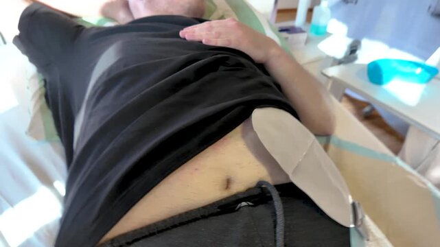 Colostomy patient in hospital bed while nurse explains ostomy care procedure during clinical instruction