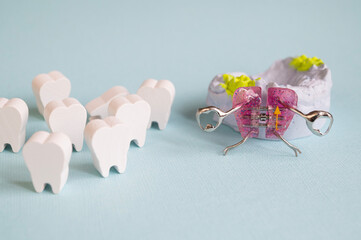 An orthodontic plate with an orthodontic screw for widening a child's upper jaw. Correcting dental alignment in children is a medical concept. © dore art