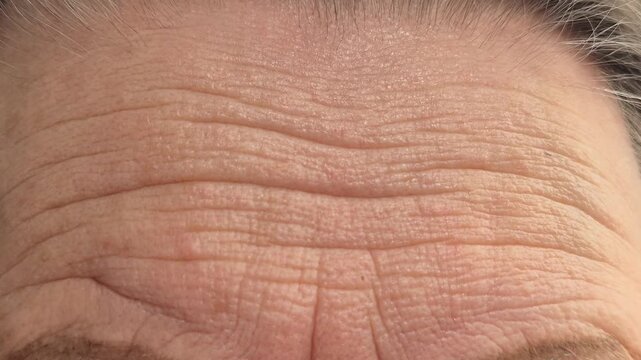 Close-up of wrinkled skin on an elderly woman's forehead