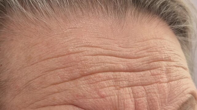 Close-up of wrinkled skin on an elderly woman's forehead