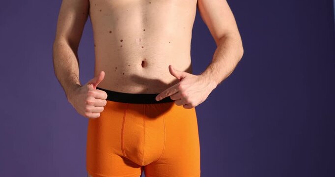 Urology. Man in orange underwear showing thumbs up and pointing at his groin on purple background, closeup