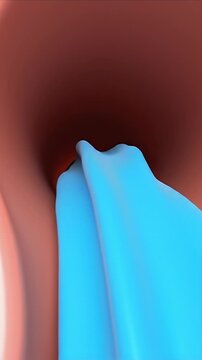Close Up CGI Visualization of Enlarged Adenoids with Clear Blue Fluid Streams Indicating Airflow Obstruction Healthcare Education Animation