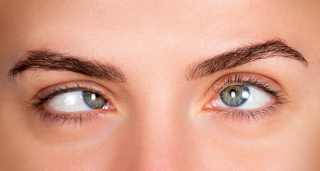 Obraz premium Strabismus human eyes macro detail. Strabismus ophthalmic vision disorder concept. Strabismus female facial expression closeup. Strabismus sideways eye look.