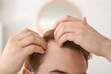 Fototapeta premium Young redhead man with hair loss problem in bathroom, closeup