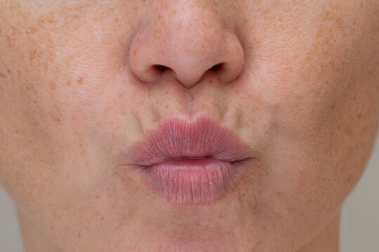 Close up of natural lips on lower cropped face, puckered expression with purse string or perioral wrinkles