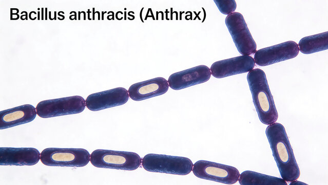 Micrograph of Bacillus anthracis (Anthrax) bacteria, long chains of large rod-shaped bacteria, some developing central spores