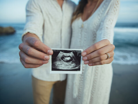 Expecting parents ultrasound ocean beach couple pregnancy sonogram hands maternity announcement mother father ring white dress casual clothing