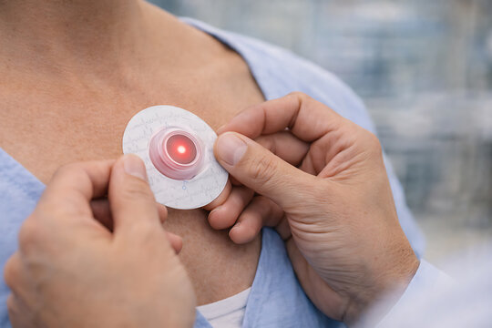 Medical Adhesive Patch Sensor Attached to Patient Chest for Health Monitoring