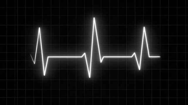 Neon white electrocardiogram heartbeat pulse line moving across a black digital screen with a hospital monitor grid pattern