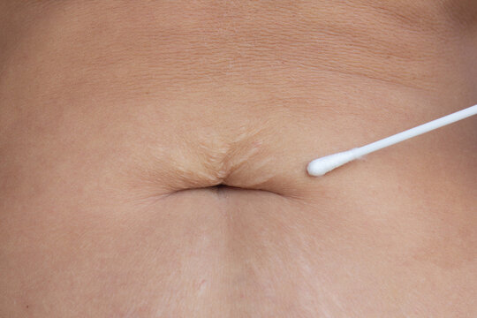 Gentle Navel Care with Cotton Swab