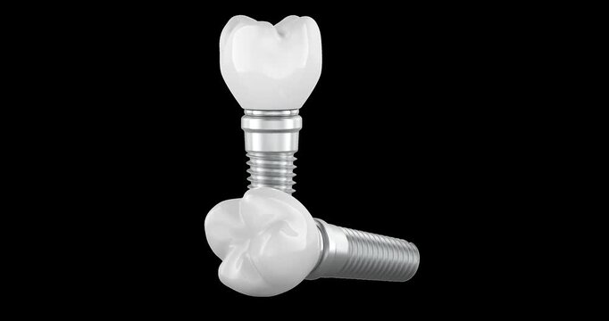 Two dental implants with ceramic crowns rotation animation seamlessly loopable. 3D rendering isolated on transparent background