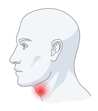 Profile view of a human head with a red glowing spot indicating pain or inflammation in the throat area. Vector illustration. ENT Series.