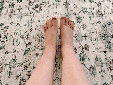 Legs with swelling. Swelling during pregnancy
