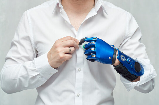 Close-up of man with bionic prosthetic arm buttoning up a white shirt, artificial limb performing everyday task, fine motor skills and independence concept