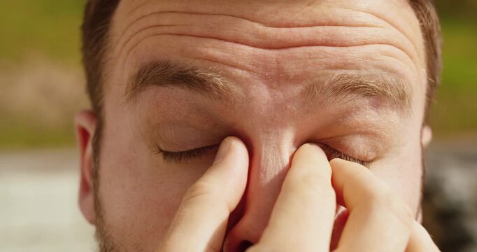 Close-up of a man rubbing his eyes due to irritation caused by pollen allergy. Concept of seasonal allergies, itchy eyes, hay fever symptoms, and allergic reactions.