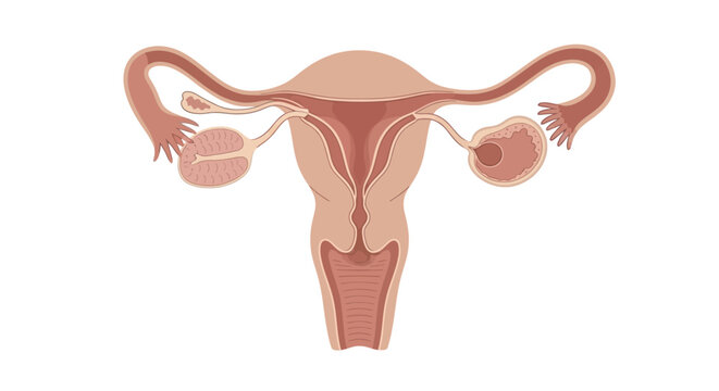The image depicts a detailed anatomical illustration of a female reproductive system including ovaries fallopian tubes uterus and vagina in a medical context.
