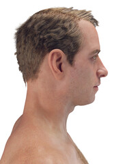 3D Anatomical Illustration Highlighting The Head Of A Male Body © Sebastian Kaulitzki