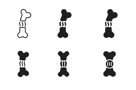 Bone Healing Icons. How bones heal after an injury. Icon set. Set Logo of How bones heal after an injury: broken bone with callus formation. harmonious logo