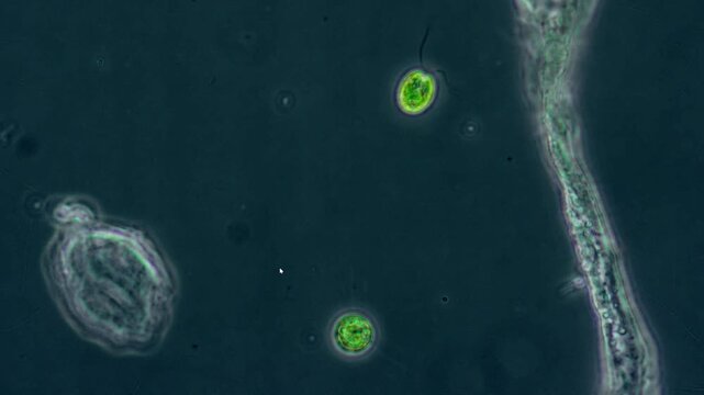 Two cells of Euglena viridis move their flagella in liquid, a microscopic view of the world under magnification.