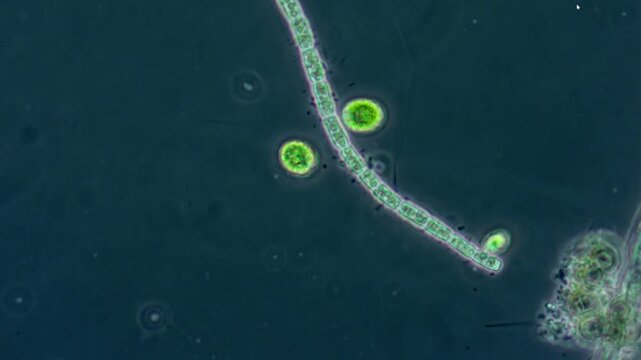 Two cells of the green unicellular euglena move slowly next to a segmented filamentous alga.