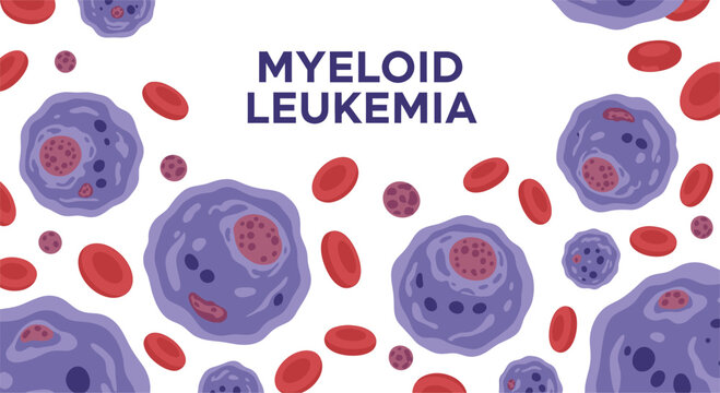 Myeloid Leukemia medical illustration with abnormal white blood cells and red blood cells, cancer awareness concept.