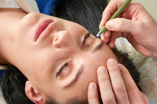  plastic surgeon and young woman with correction lines before cosmetic surgery, drawing lines on eyes