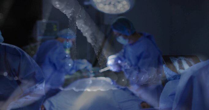 Operating surgical team performing surgery in OR wearing blue sterile gowns, showing x-ray