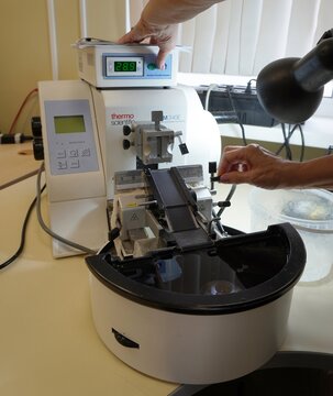A Thermo Scientific HM340E rotary microtome prepares tissue sections in a pathology laboratory. The precision instrument cuts paraffin blocks for microscopic examination.  
