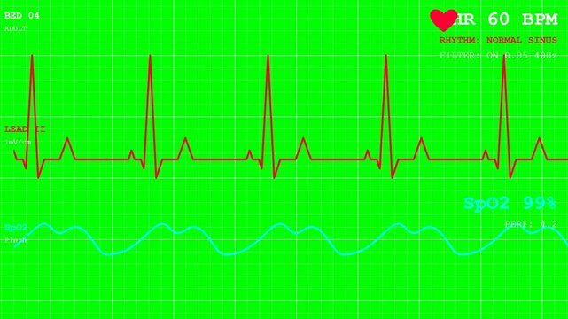 Dynamic Medical Monitor Displaying Real-Time Vital Signs, Heart Rate, and Oxygen Saturation Data