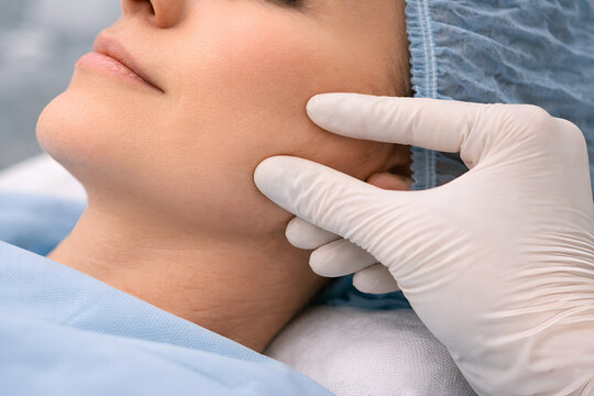 Photorealistic medical aesthetic procedure: adult patient lying on treatment bed during thread lift, face partially cropped to avoid identity, sterile drapes, hair cap, clinician wearing gloves, mask