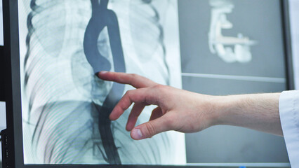 Hand of a doctor pointing at a detailed x-ray image on a screen, analyzing results