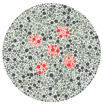 Eye Health Educational Material Regarding Color Blind Test for Medical Students

An educational chart showing a color blind plate, ideal for textbooks, medical blogs, or optometry sc