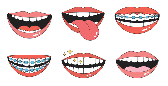 Cartoon lips illustration set, colorful mouth expressions with teeth, tongue, braces and smiling female characters playful vector collection.